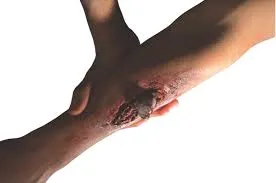 Theatrical Effects - Broken Bone